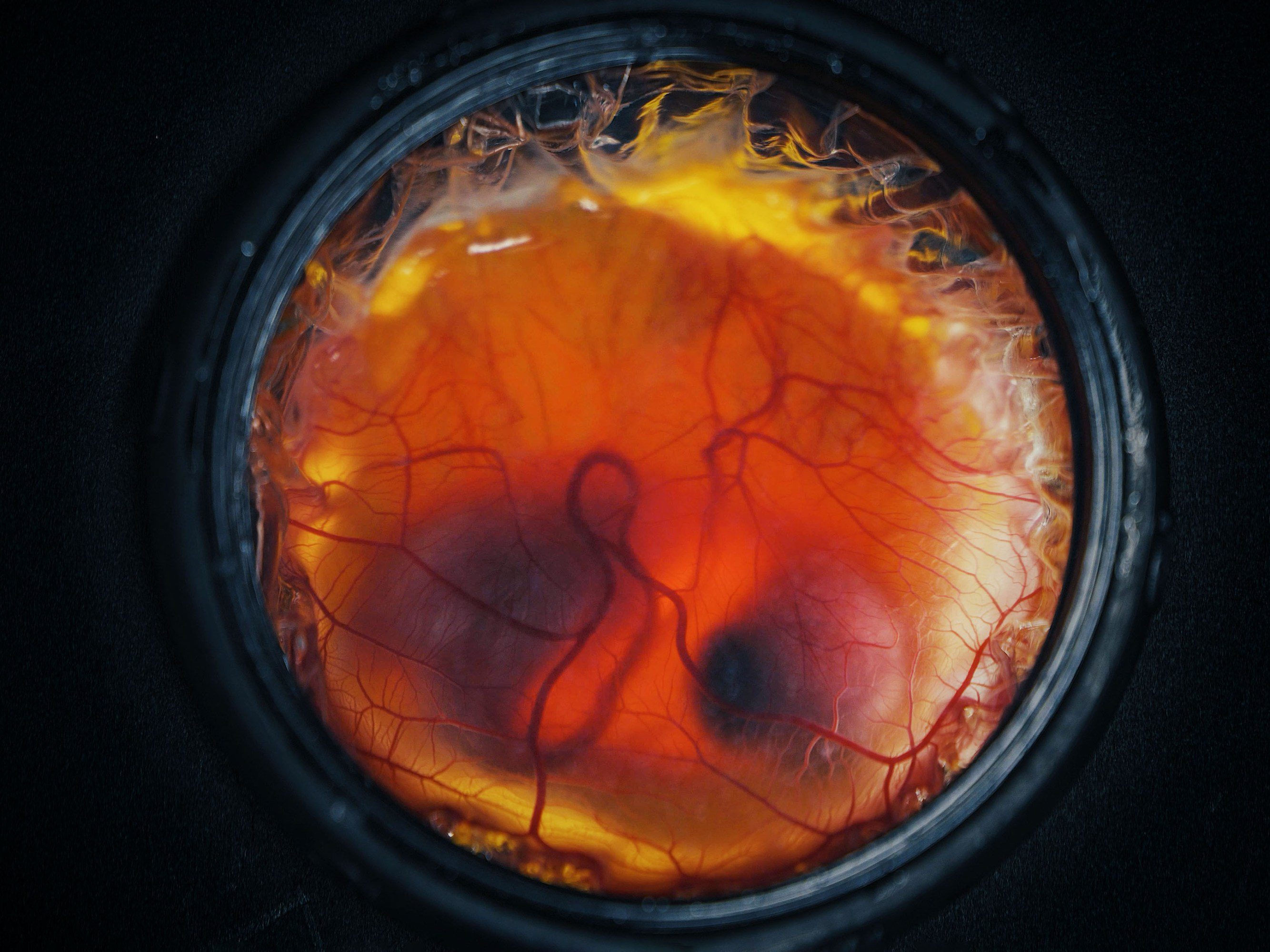 looking down into the artificial egg shell to see a developing chick embryo and its vascular structure